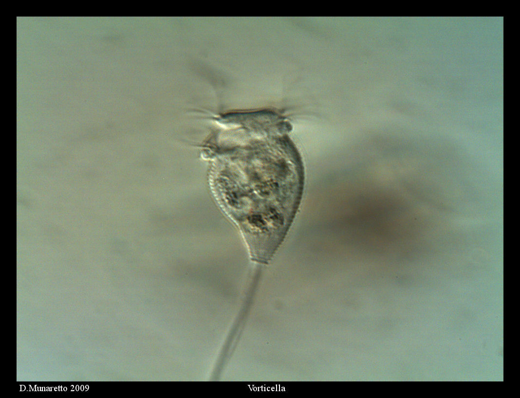 Vorticella